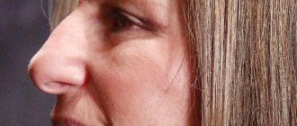 Actresses with big noses