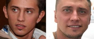 Pavel Priluchny ear plastic surgery
