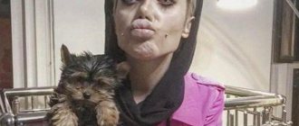 A Jolie fan has had many surgeries, wanting to be like the actress.