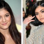 Compare photos of Kylie Jenner before and after plastic surgery