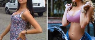 Звезды российского Instagram до и после пластики: шокирующие фото